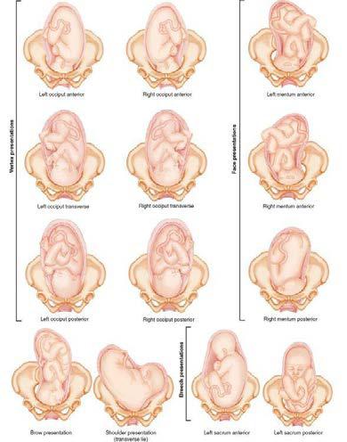 Fetal Positions Before Birth..