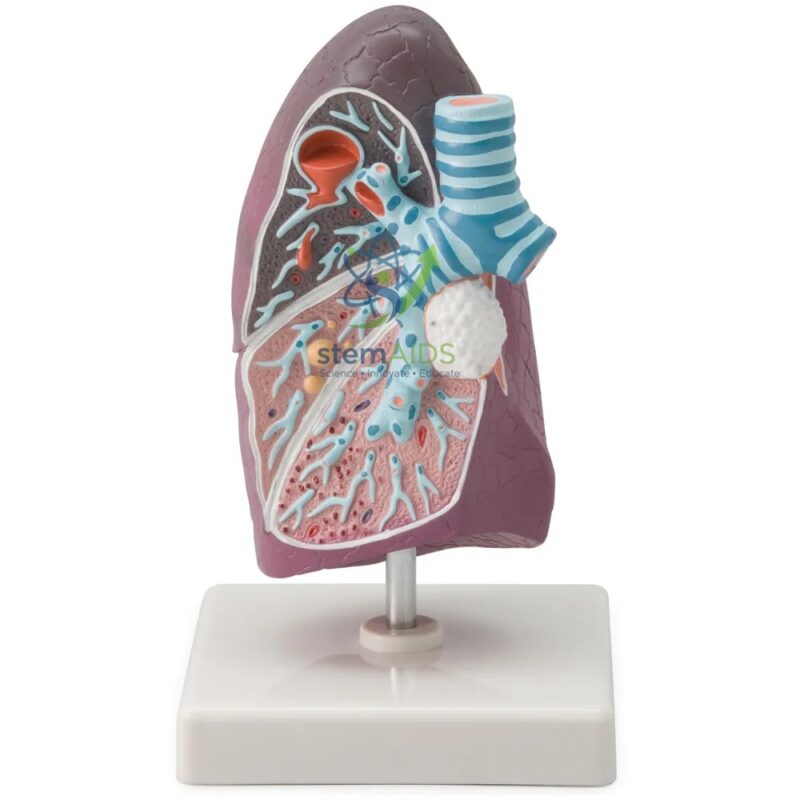 Anatomical Model of a Pathological Human Lung 1 Anatomical Model of a Pathological Human Lung - Biology Lab Products | STEMAids