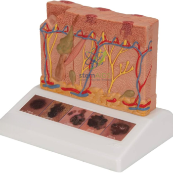 Home 8 24 Skin Cancer Model - Biology Lab Products | STEMAids